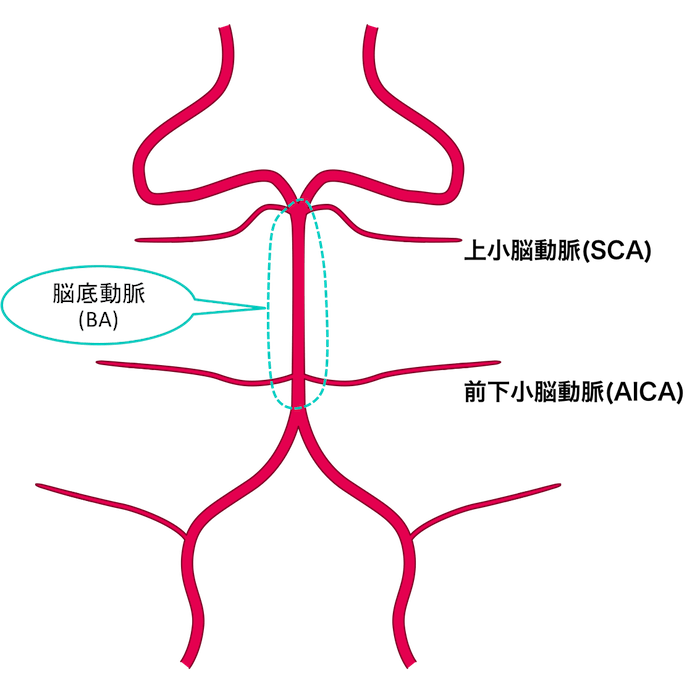 脳・頭頚部血管のNormal Variations 脳・頭頚部血管のNormal Variations (日本語) 単行本 公式通販